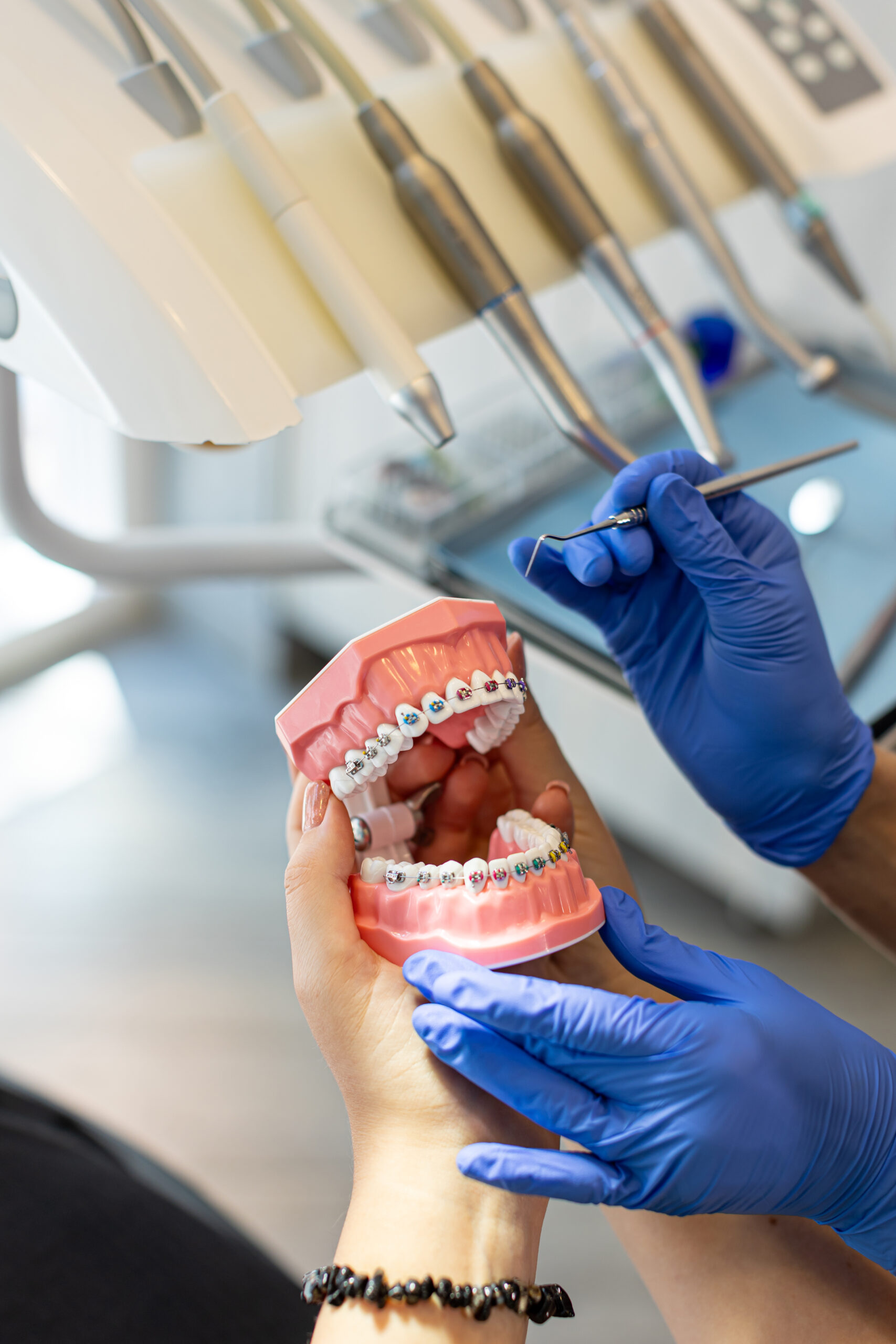 Fogszabályozás kicsi kép