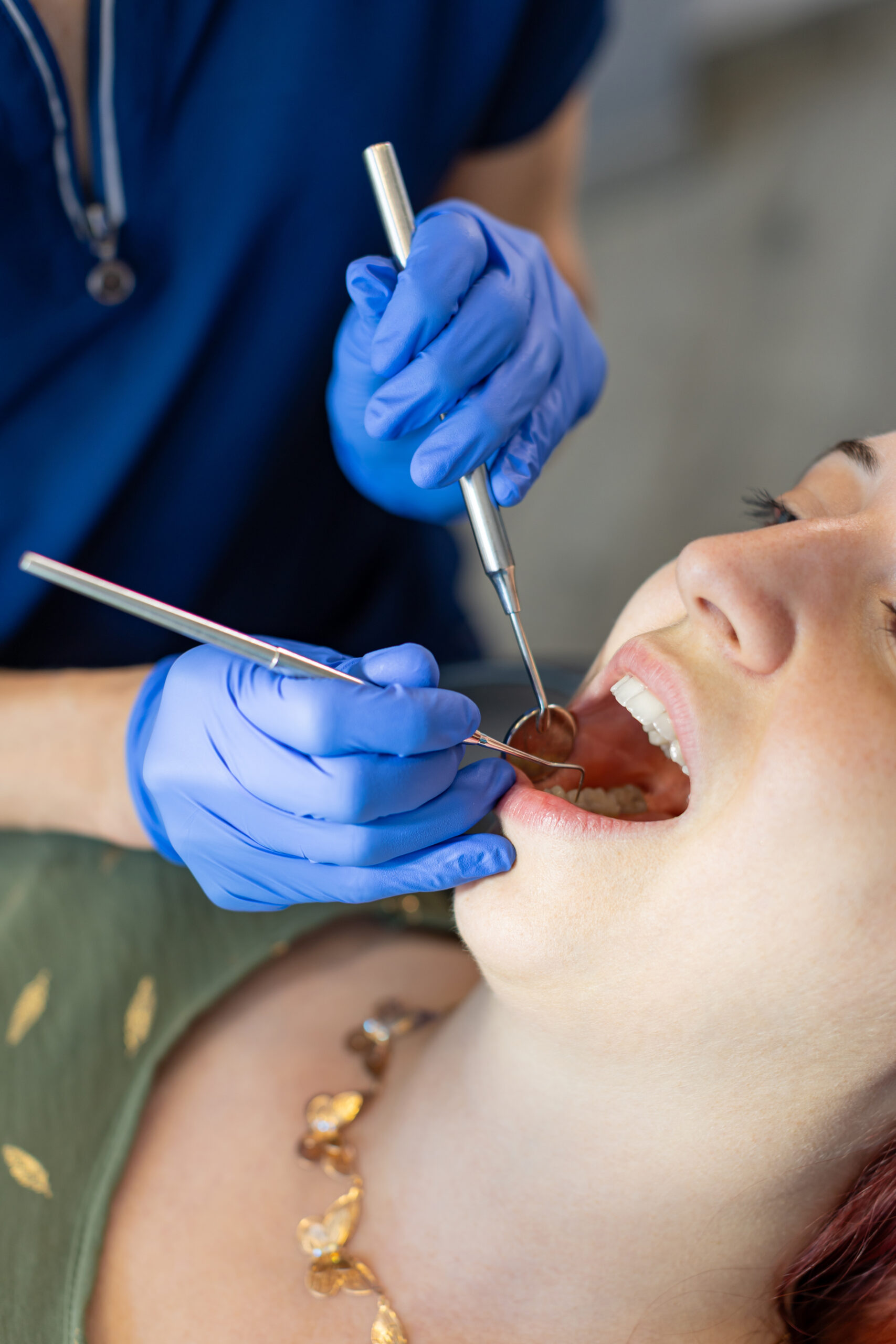 fogeltávolítás kicsi